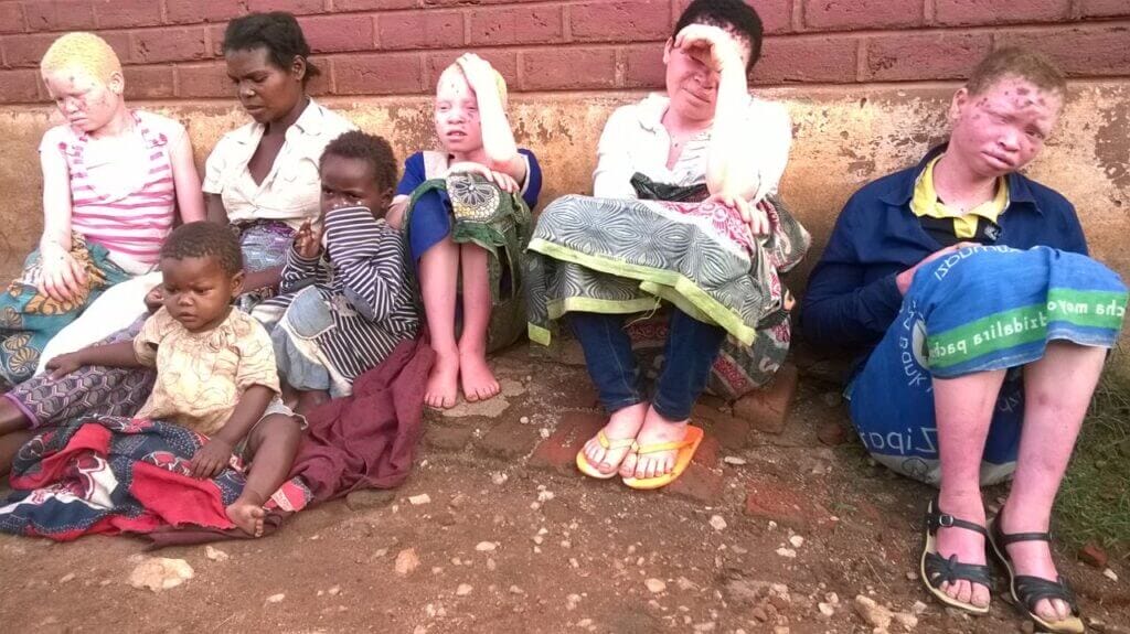 Albino Killings
