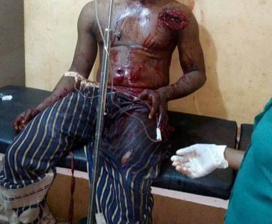 Anti-Bullet Charms and Destructive Power of Superstition in Africa 
