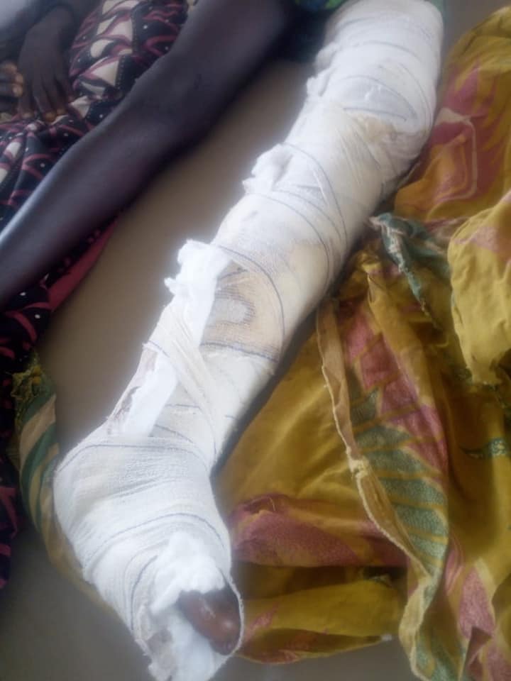 Malawian teenager rescues friend from the jaws of crocodile