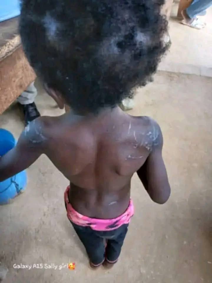 child abuse by stepmother: