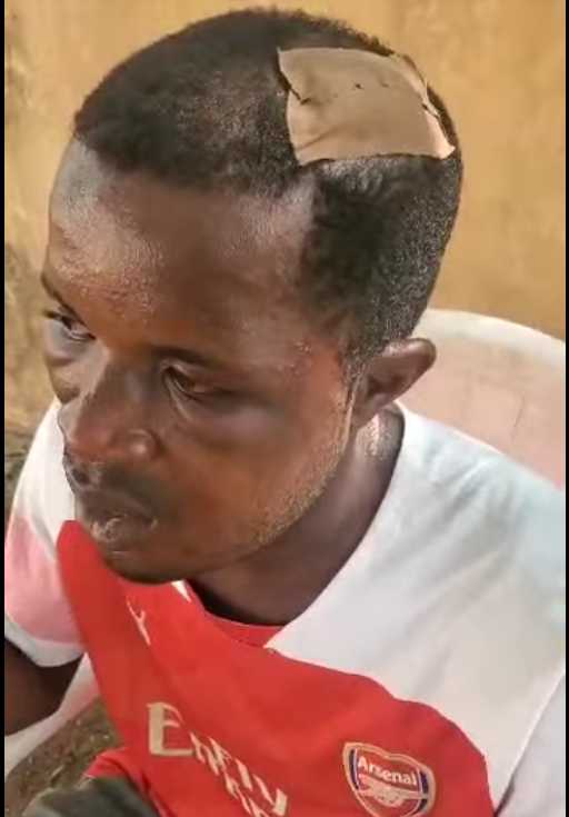 Delta State: Those Who Raise False Alarms Over Penis Disappearance Must Face Justice